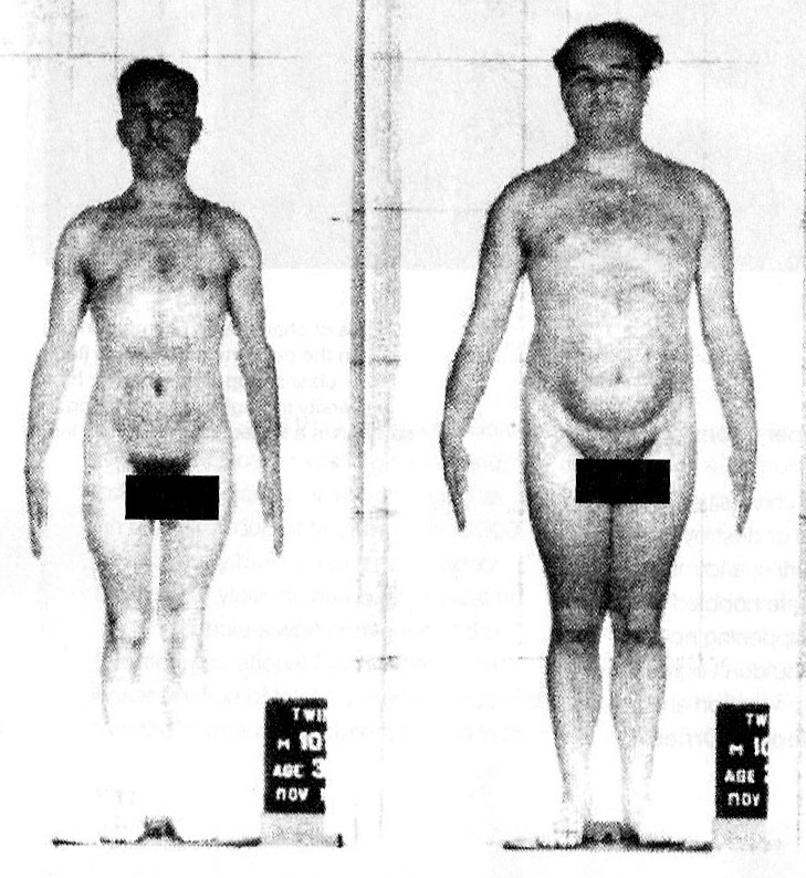 It’s not all in the genes. Ask any epigeneticist. Ramifications for cloning. 1 men identicle twins.jpg