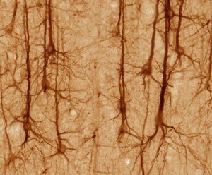 Image by U.C. Regents Davis (Creative Commons)